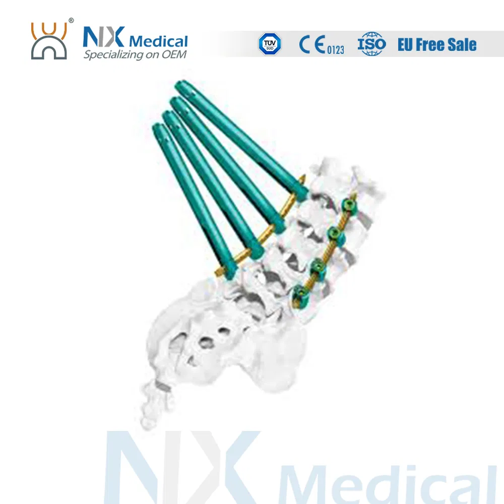 Orthopedic Implant Cannulated Bone Cement Spinal Pedicle Screw 5.5mm System