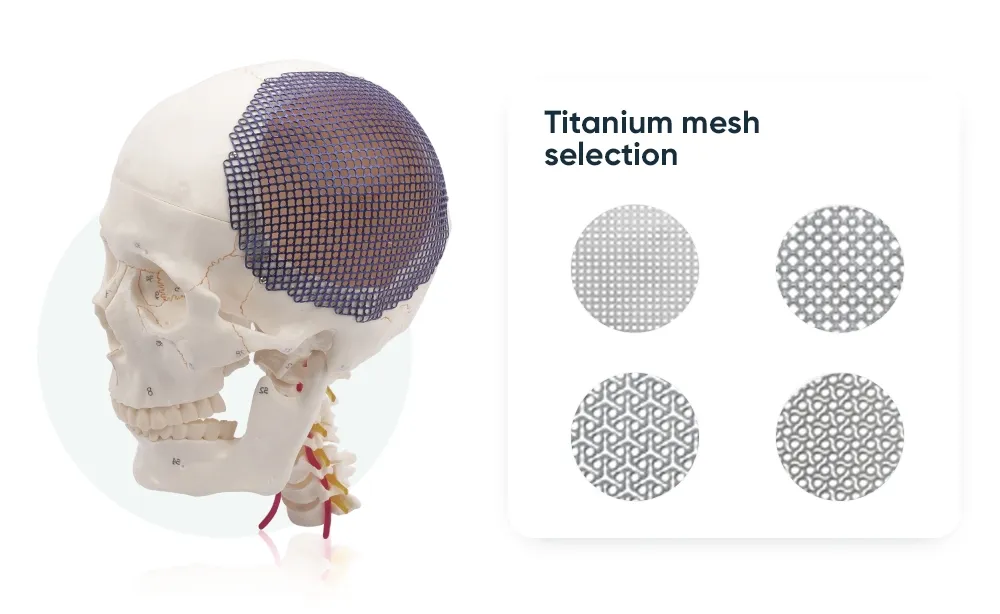 Surgical Titanium Mesh