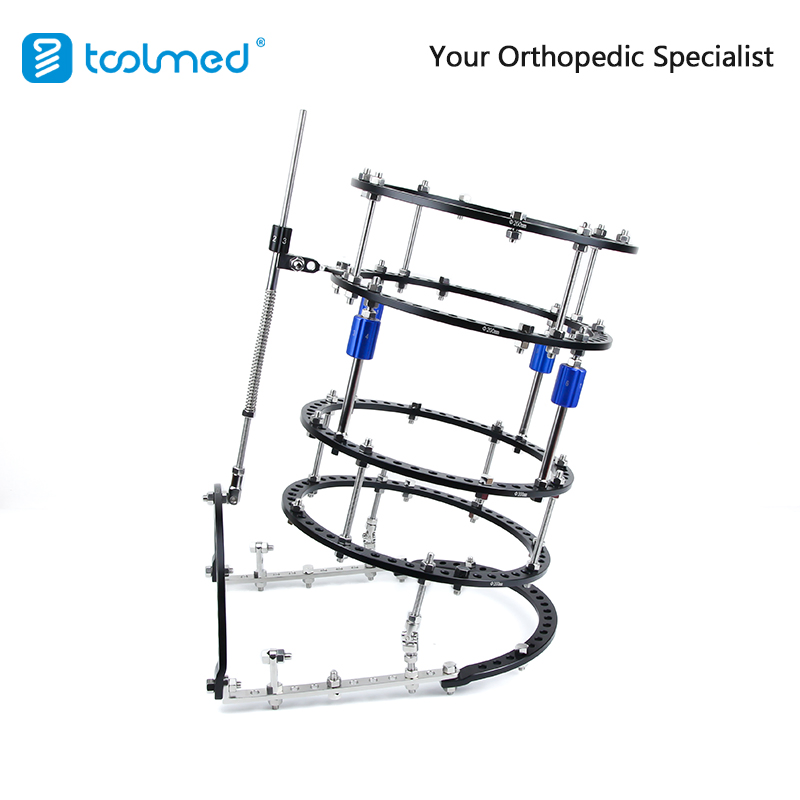Talipes Equinovarus &amp; Equinovalgus External Fixator for Pediatric Foot Deformity Correction and Bone Lengthening
