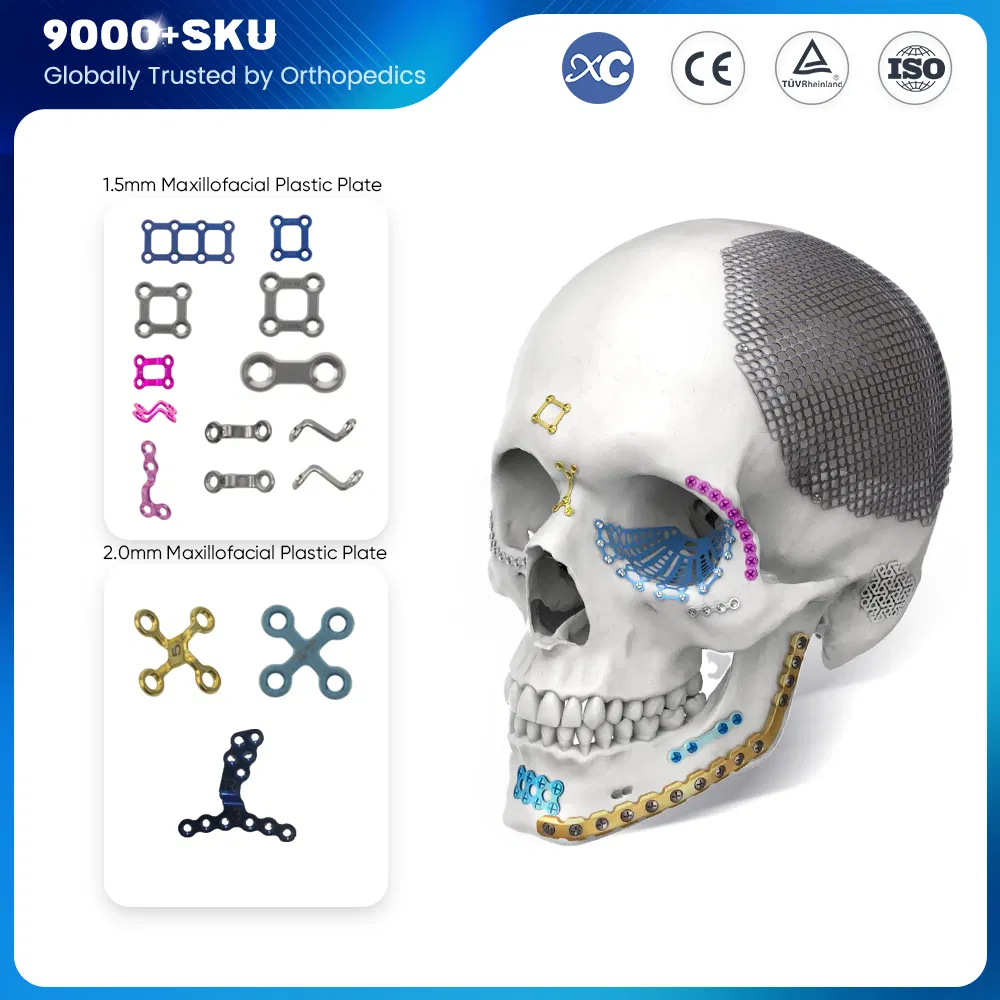 Cmf Medical Orthopedic Plastic Surgical Locking Titanium Implant Mini Maxillofacial Plastic Plate