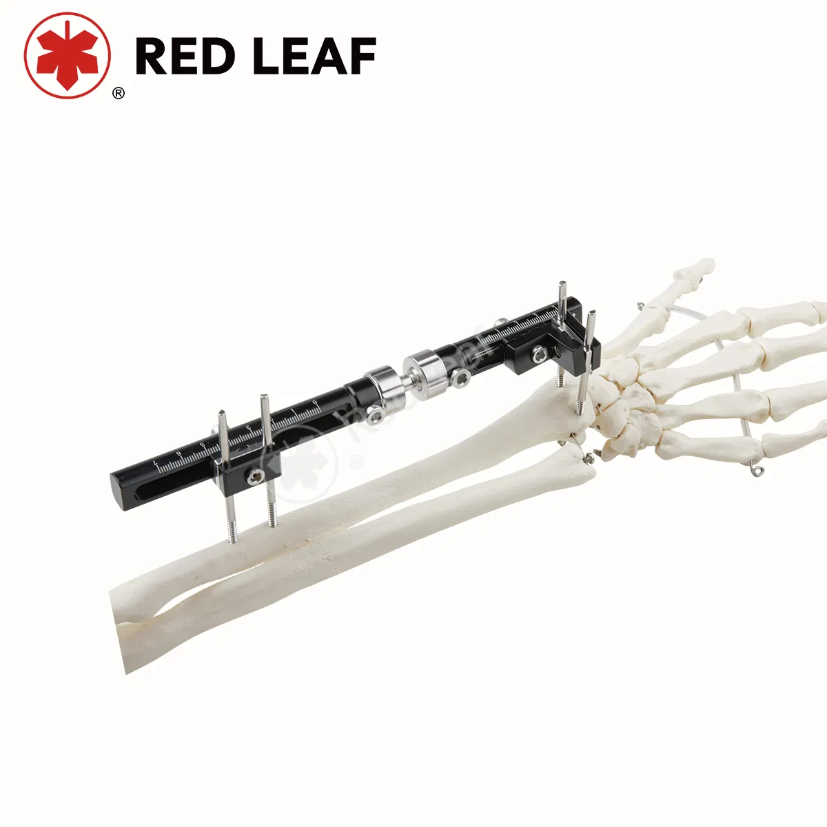 Orthopedic Surgical External Fixator Wrist L Type Fixation Device for Fracture Recovery