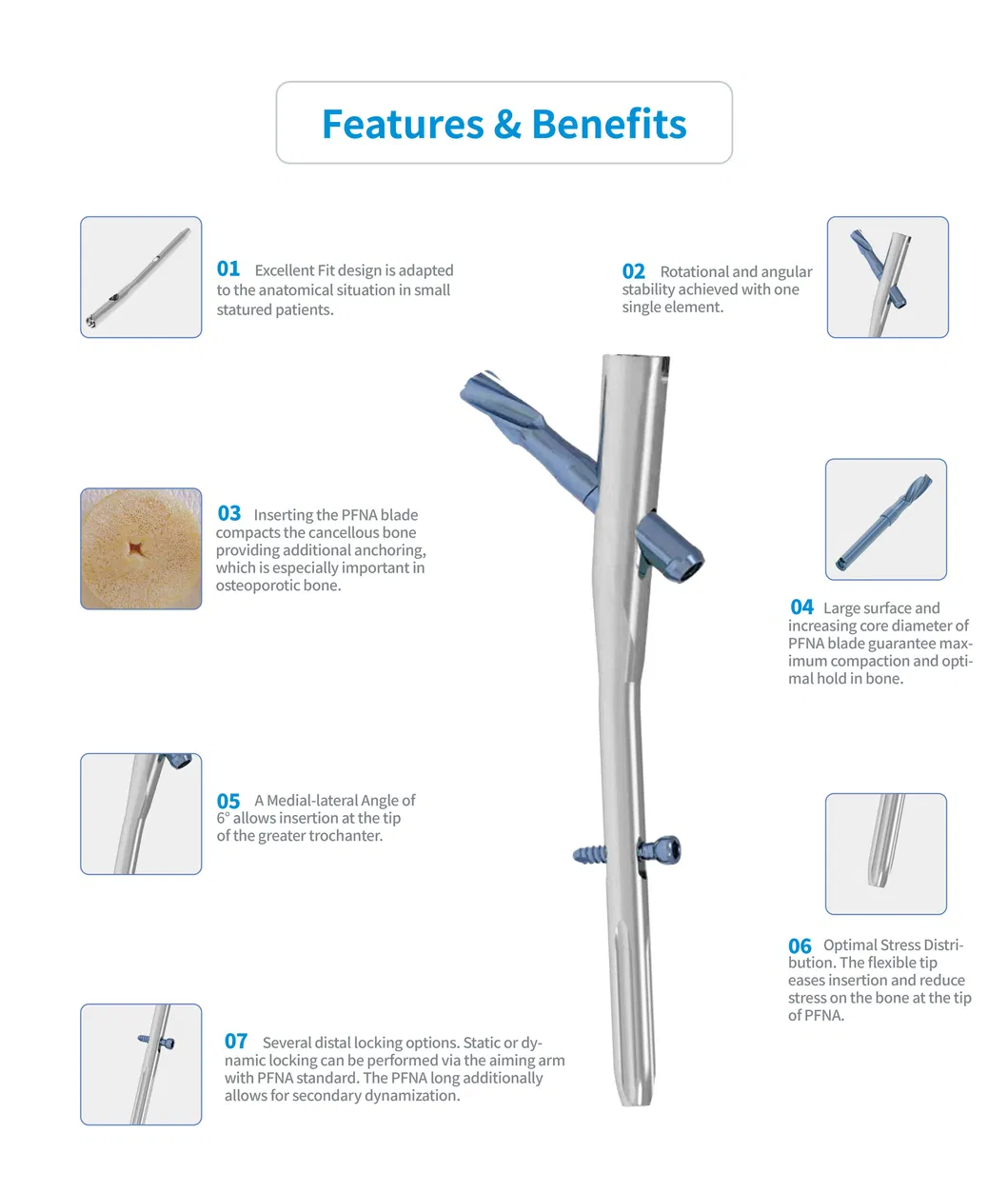 Orthopedic PFNA Nail 2