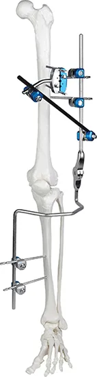 Knee Joint Mobilizer