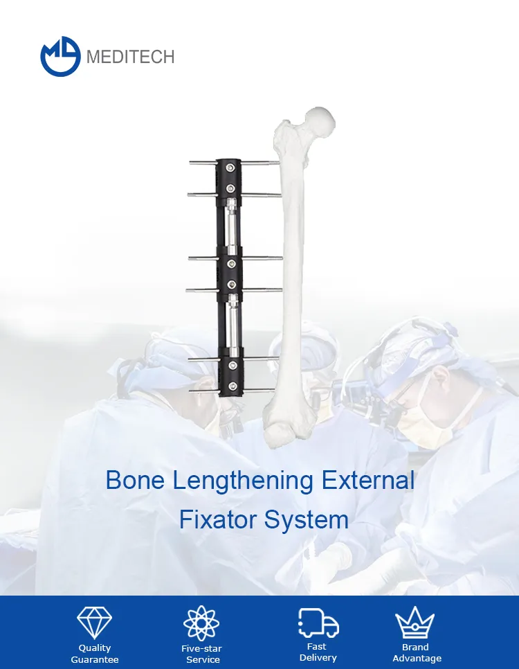 Bone Lengthening External Fixator
