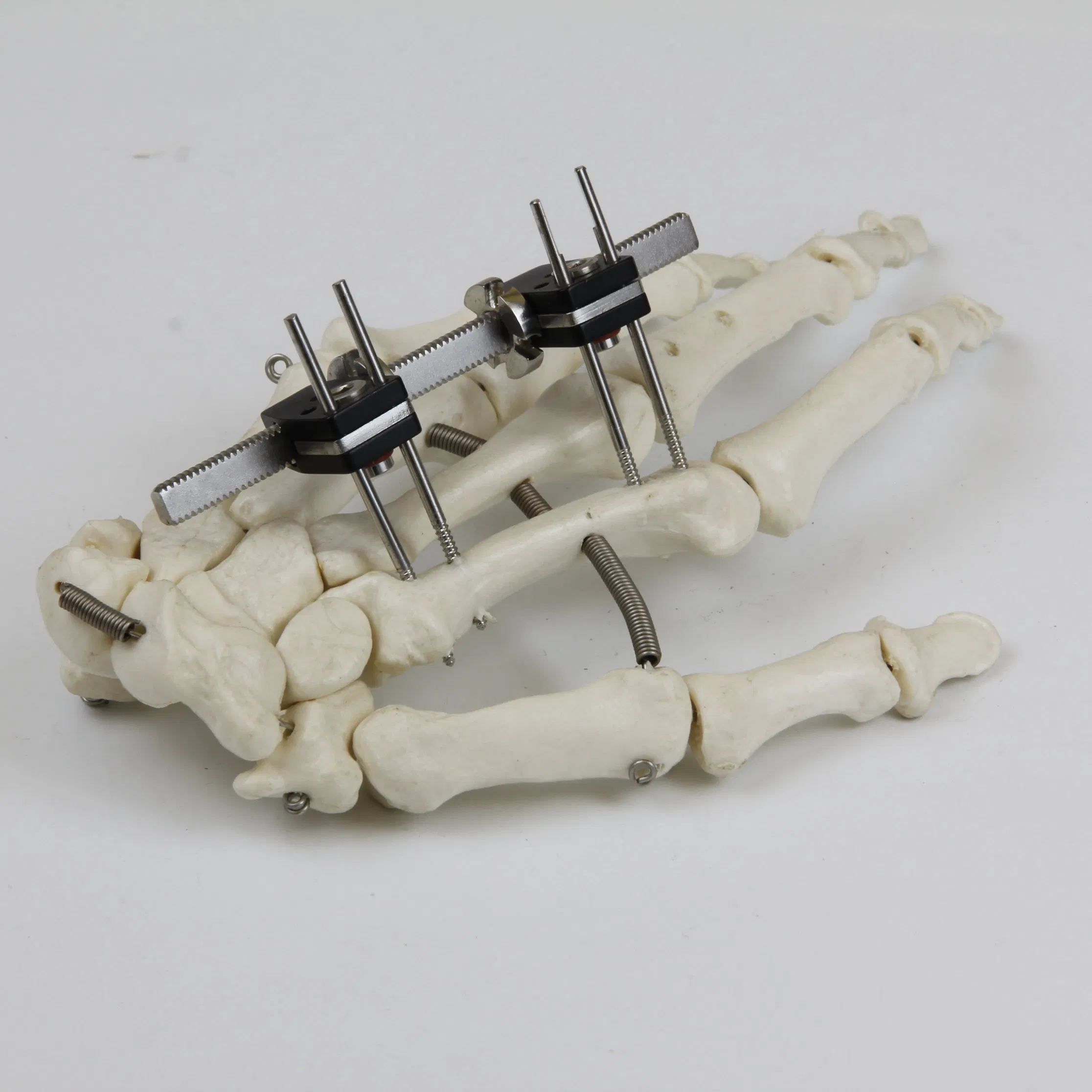 Universal Mini Palm External Fixator for Finger Fracture Orthopedic Surgical