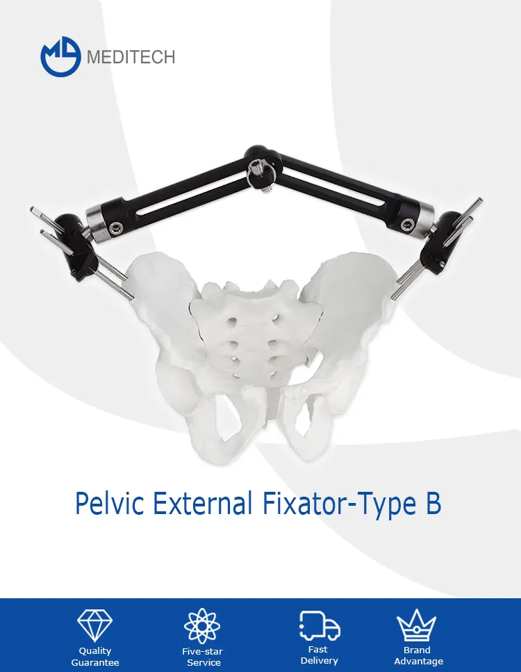 Pelvic Fixator Image 1