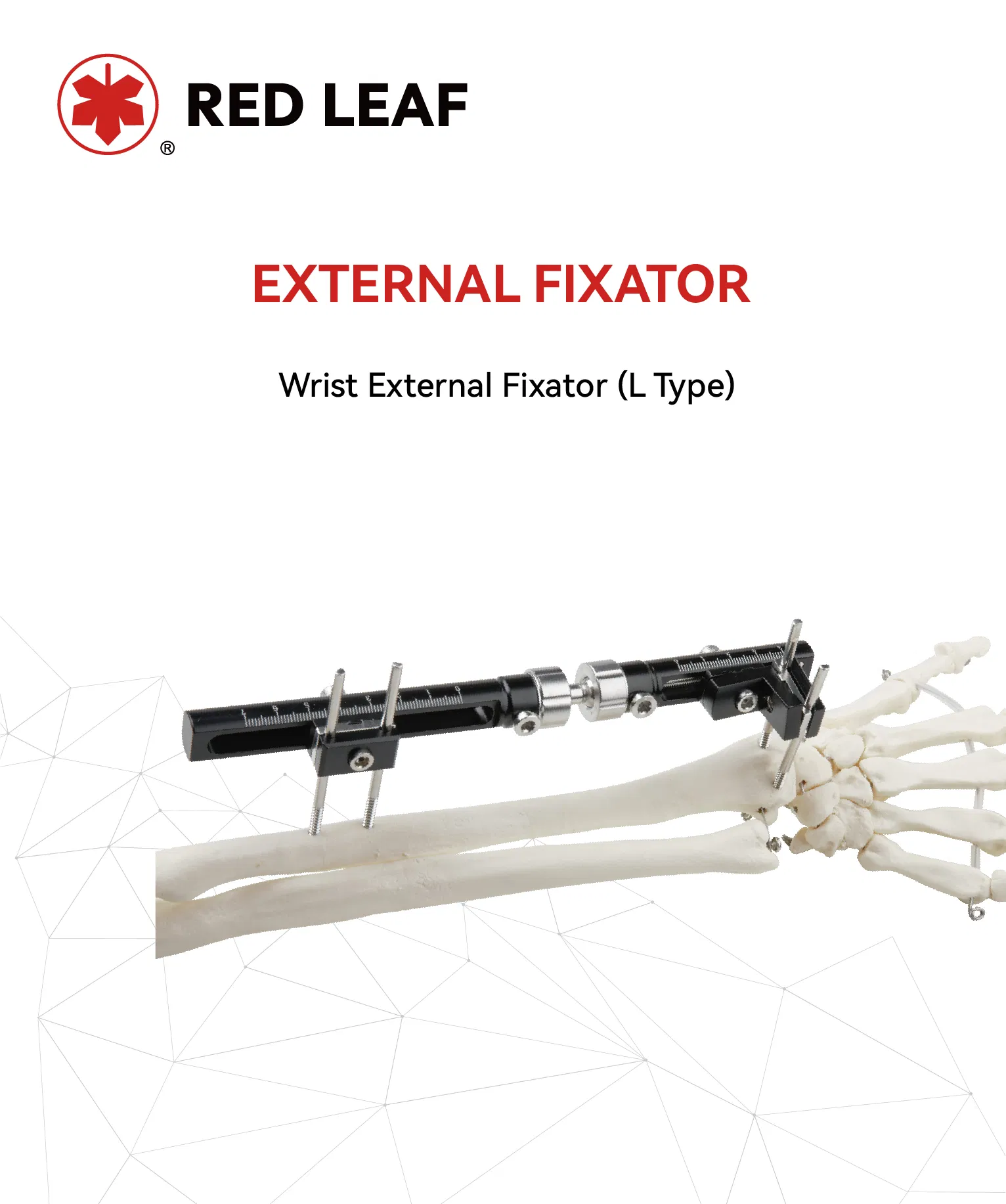 Orthopedic Surgical External Fixator