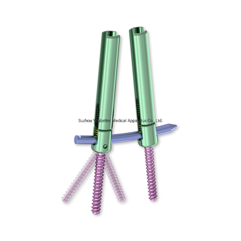 Titanium Orthopedic Pedicle Screw System
