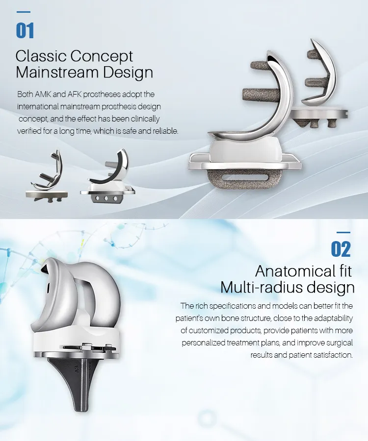 Knee Prosthesis Detail 3