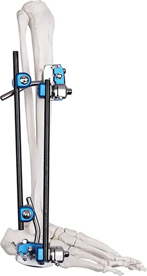 Ankle Joint Mobilizer