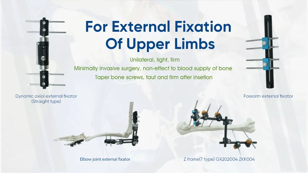 External Fixator Description