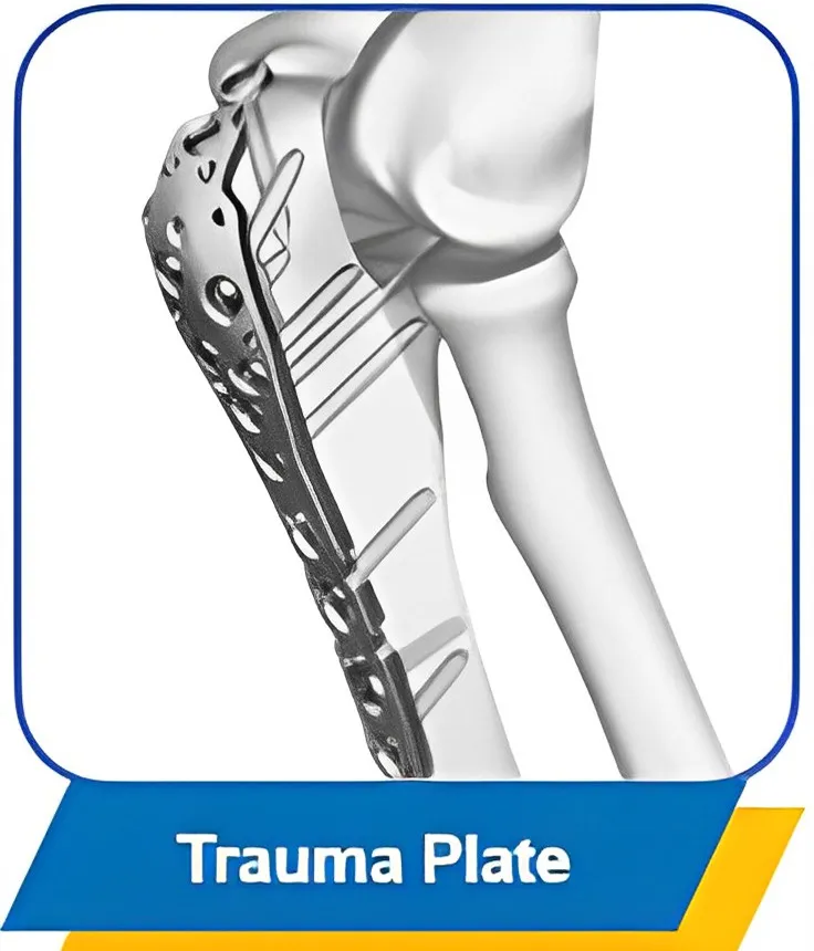 Trauma Plate