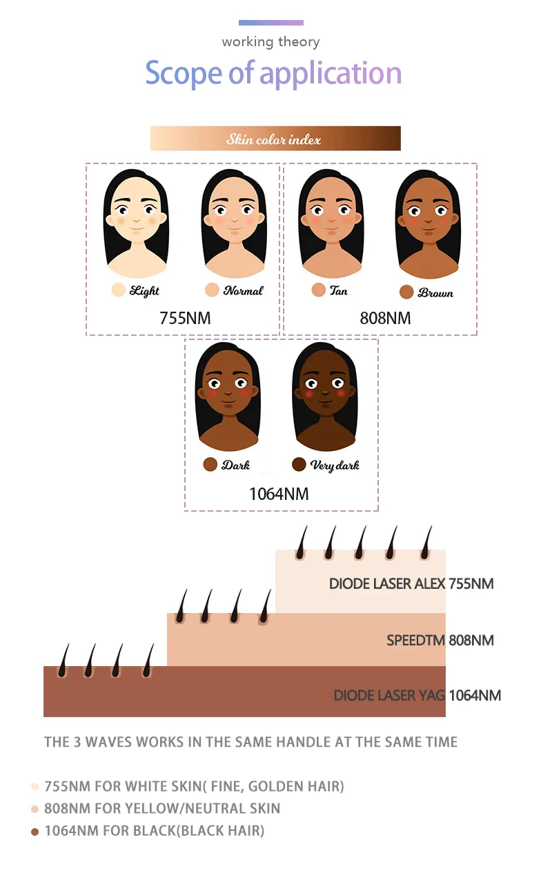 Laser Lifetime Comparison and FAC Technology Advantage