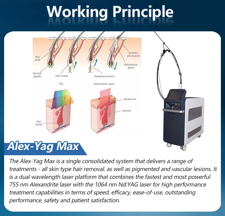 PRO Laser Hair Removal Equipment 755nm Alexandrite Laser 1064nm Long Pulse Technology