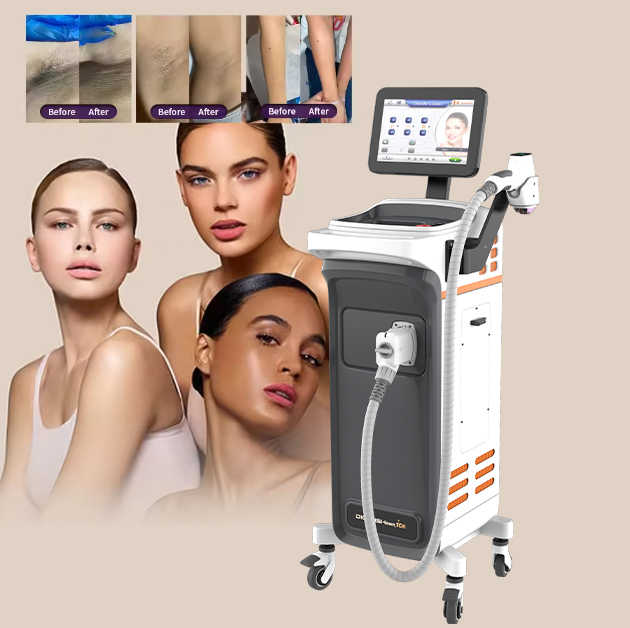 Nubway Fast Light Freezing Point Equipment Ice Alexandrite Fiber Underarm 808Nm Laser Diode Hair Removal Cute