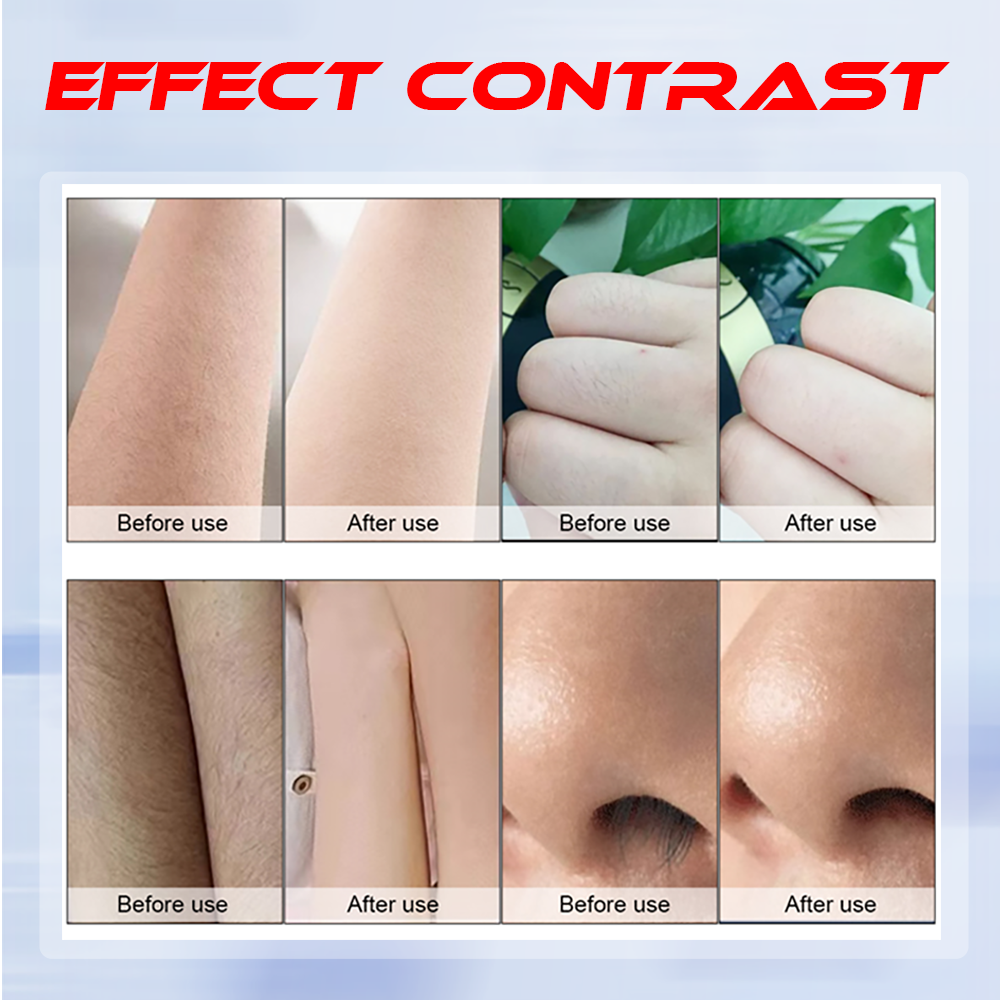 Huamei Diode Laser Hair Removal Machine Stationary Full Skin Tone Adaptation Whole Body Coverage Commercial Use Preferential