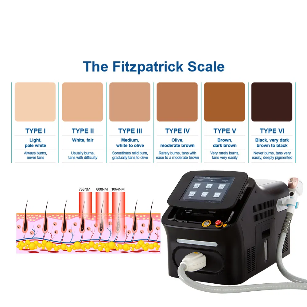 Portable 4 Wavelegths Diode Laser Hair Removal System