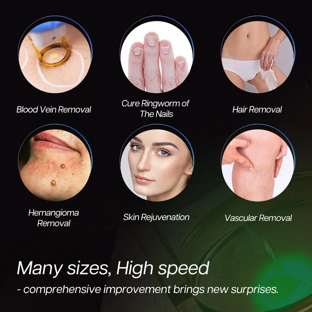 2025 New Technology Alex Laser Hair Removal 755nm 1064nm Longpulse Laser Alexandrite Laser