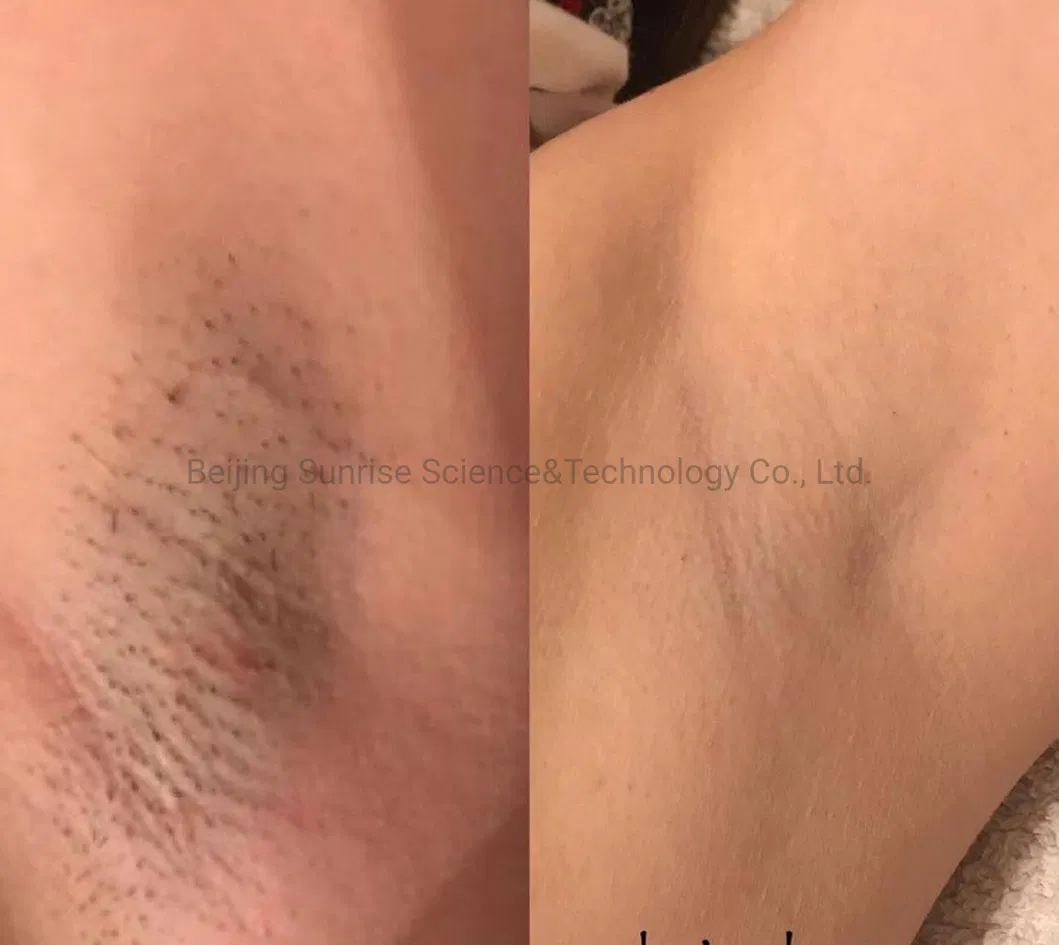 Before and After Results 1