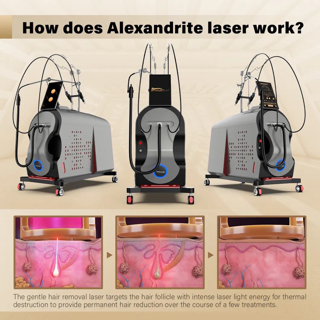 Treatment Principle of Alexandrite and NDYAG Laser