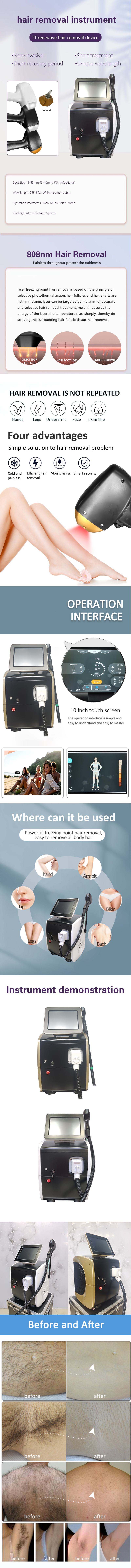 Professional High-Power 1600W 4-Wave Diode Laser Hair Removal Device 755nm 808nm 1064nm Radiator Cooling Full Body English