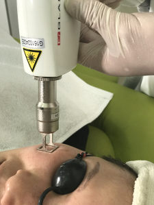 Treatment Result 5