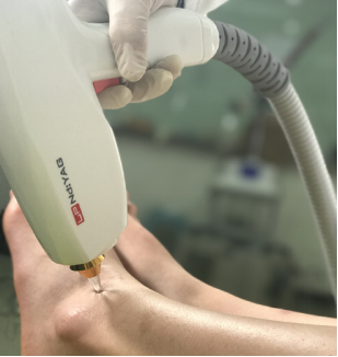 Treatment Result 4