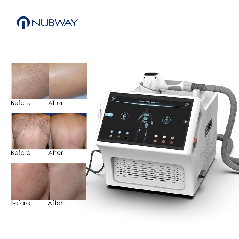 Clinic Grade Four Wavelength Laser Hair Removal System Android AI Technology Designed for Efficient Full Body Treatment