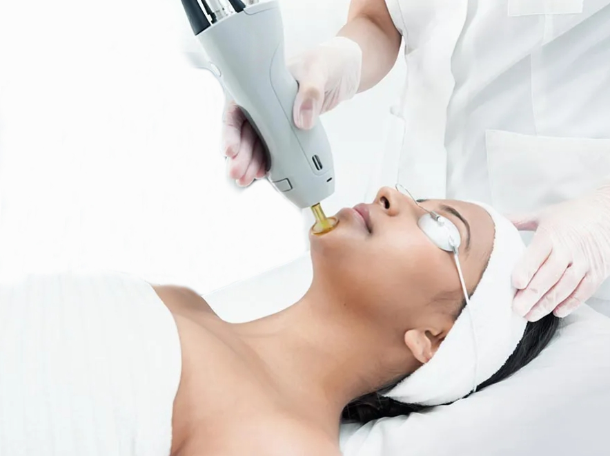 PRO Laser Hair Removal Equipment 755nm Alexandrite Laser 1064nm Long Pulse Technology