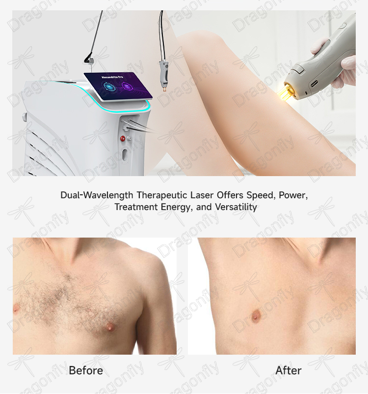 Treatment Results