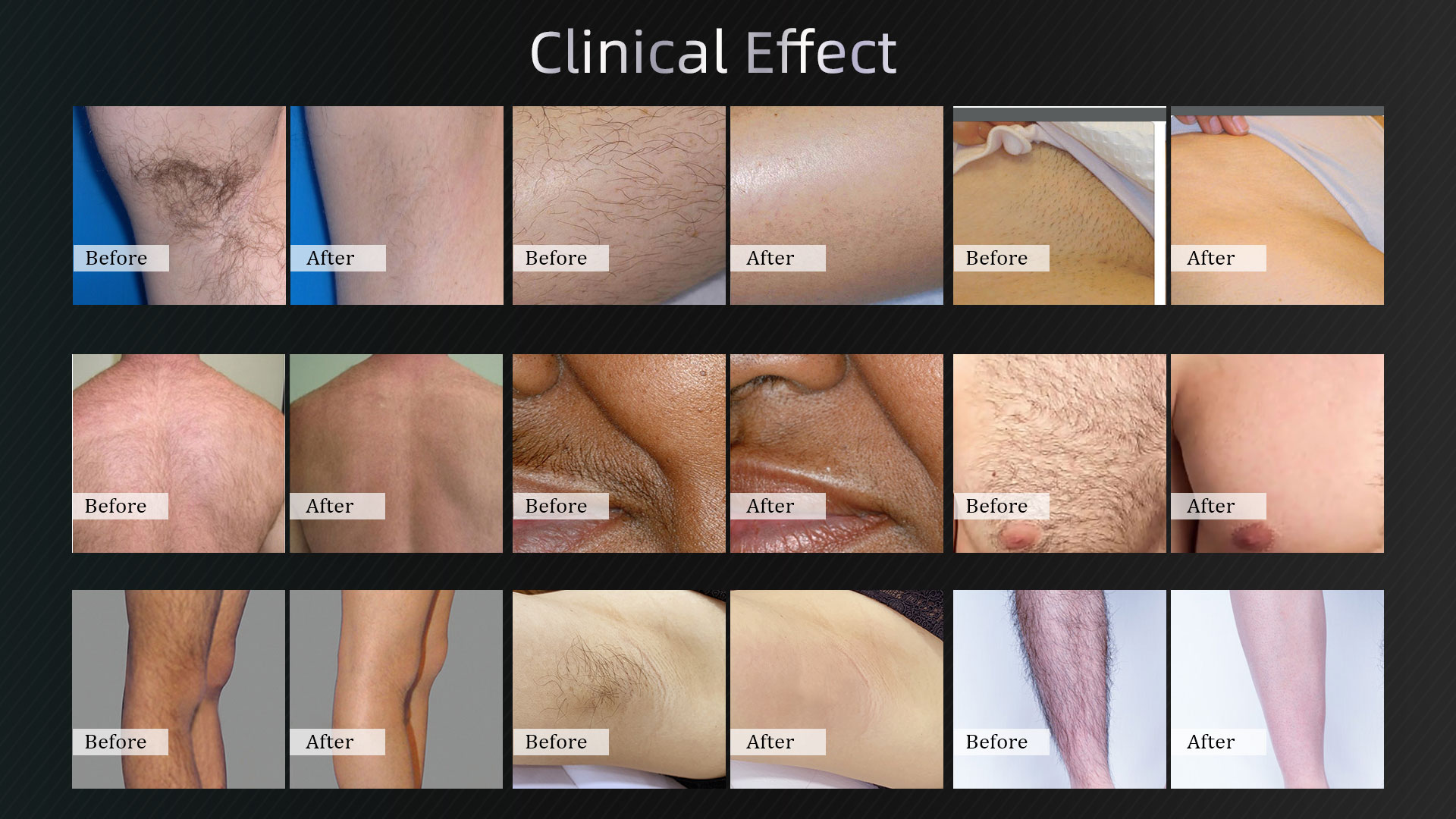 Treatment effect before and after 1