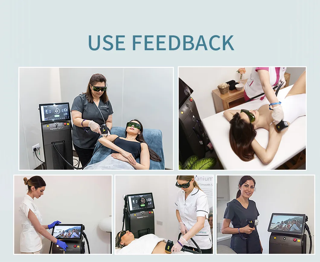 Advanced 4000W Diode Laser Hair Removal System for Smooth Skin