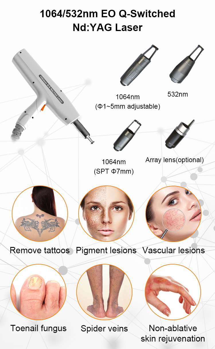 Q-Switched ND:YAG Laser Application