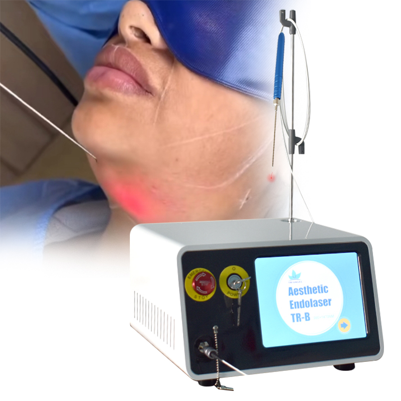 2026 Most Popular Endolaser Lifting 980nm1470nm Fiber Diode Laser Skin Tightening Facial Machine