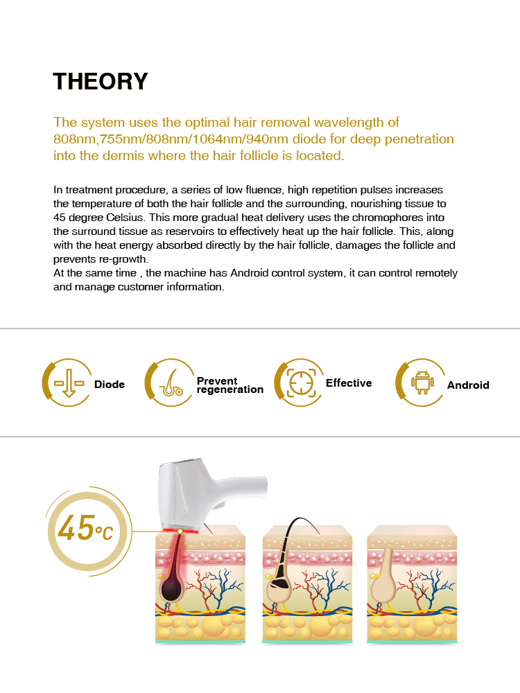 Diode Laser Details