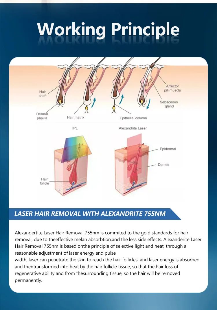755nm Alexandrite Laser Hair Removal - Advanced Pulsed Alexandrite Technology
