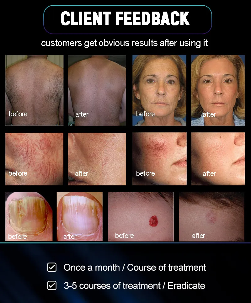 Treatment Screen Interface