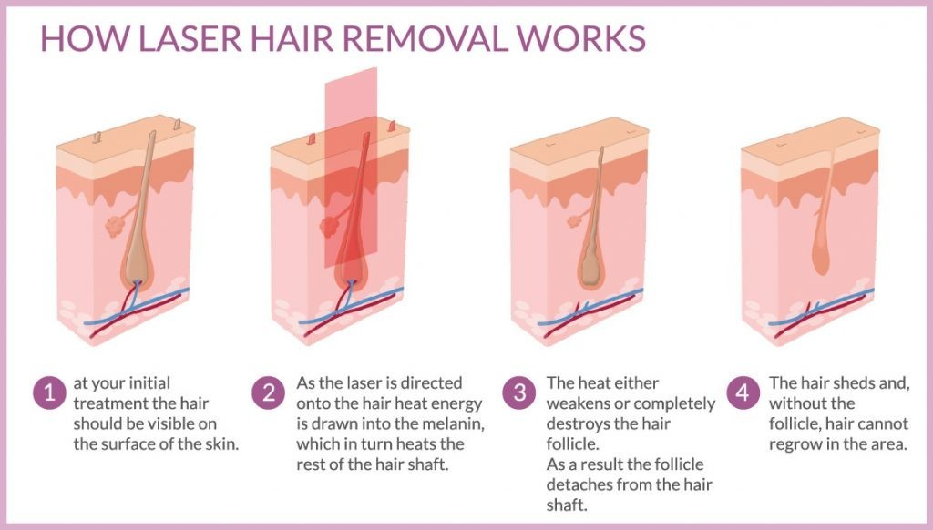 Hair Removal Treatment Screen Interface