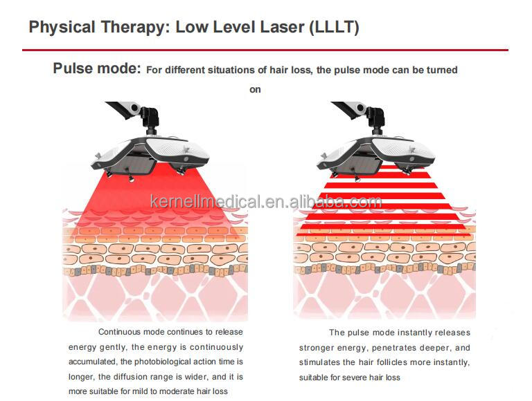 LLLT system side view