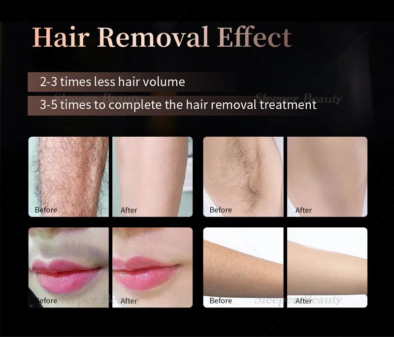 Advanced Treatment Handles Option