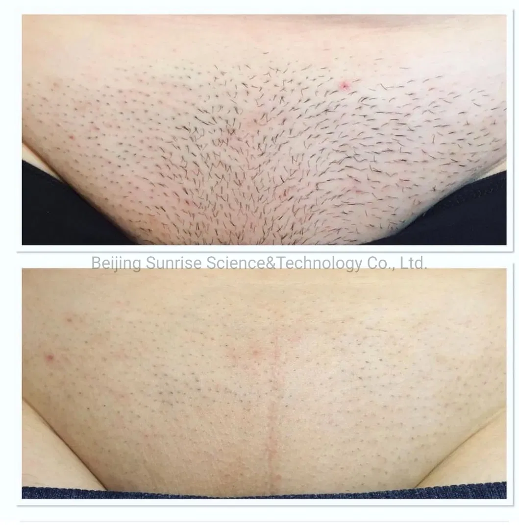 Before and After Results 2