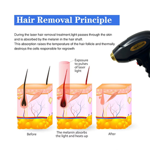 2026 New 2 In1 Blackhead Removal Pore Cleanings Tattoo Removal And 3 Wavelength Diode Lase Hair Removal Machine