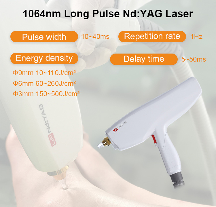 Long Pulse Nd:YAG Laser Application
