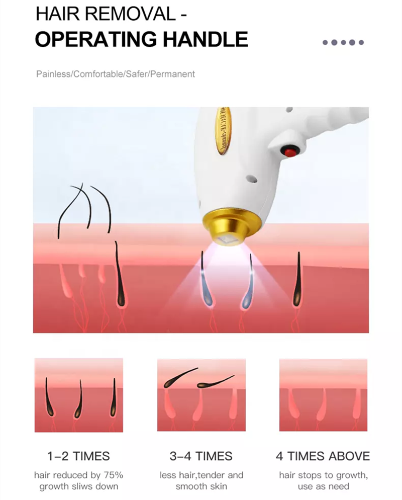 Hair Removal Machine Tech Specifications