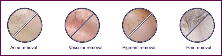 Before and After Treatment Results