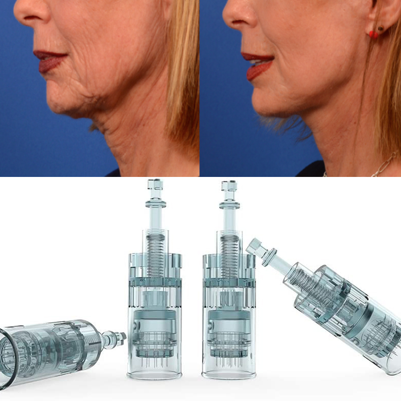 Advanced Dr Pen M8 Micro Needling System for Skin Rejuvenation
