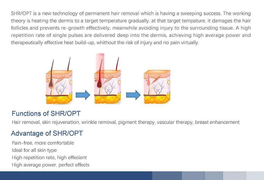 Multifunction Hair Removal Device IPL System for Permanent Hair Removal, Skin Rejuvenation, and Smooth Skin