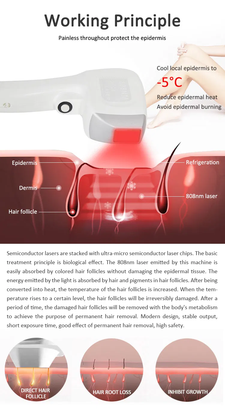 High Power Diode Laser System for Fast Hair Reduction
