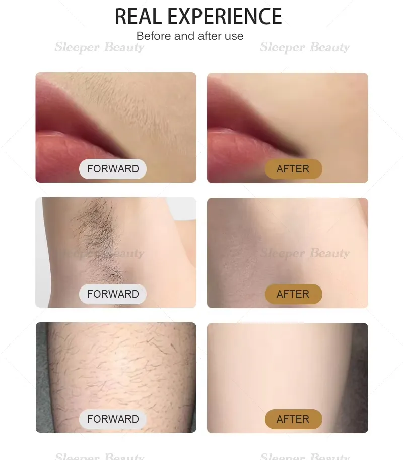 4 Wavelength Diode Laser Hair Removal System with Ice Plus Cooling -32° C Safe for Sensitive Skin Laser Hair Reduction Beauty Equipment