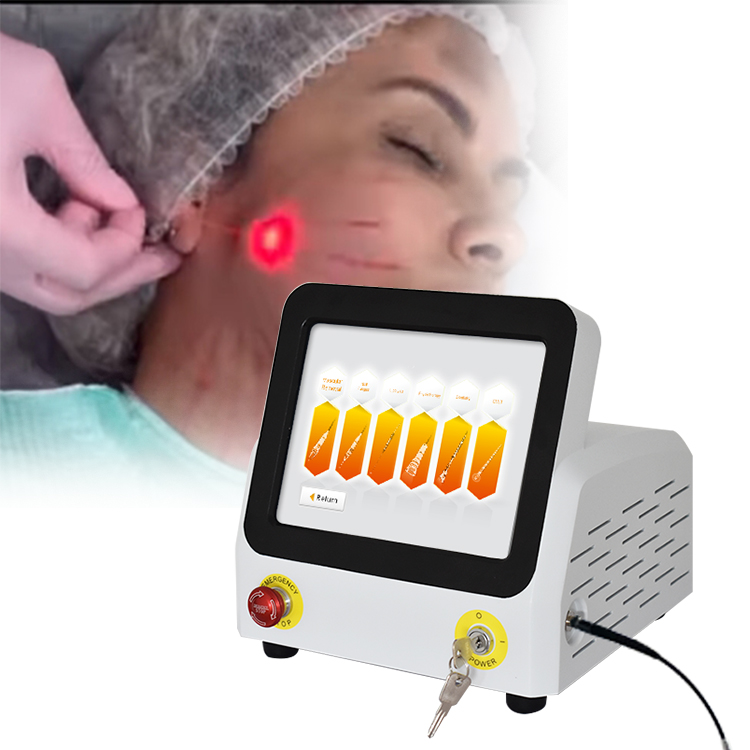 Mini Invasive Endolaser 980nm 1470nm Laser Facial Lift Liposuction Lipo Medical Laser Diode